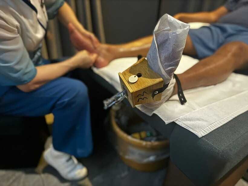 Shanghai:Authentic Chinese Body/Foot Massage, Hair& Head SPA - Cupping therapy: suction now, red marks later (that fade)